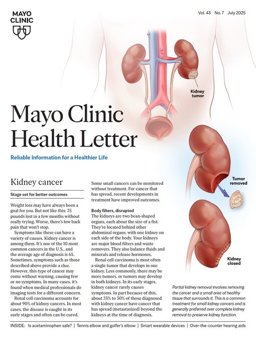 Title details for July 2025. Mayo Clinic Health Letter by Mayo Clinic - Available